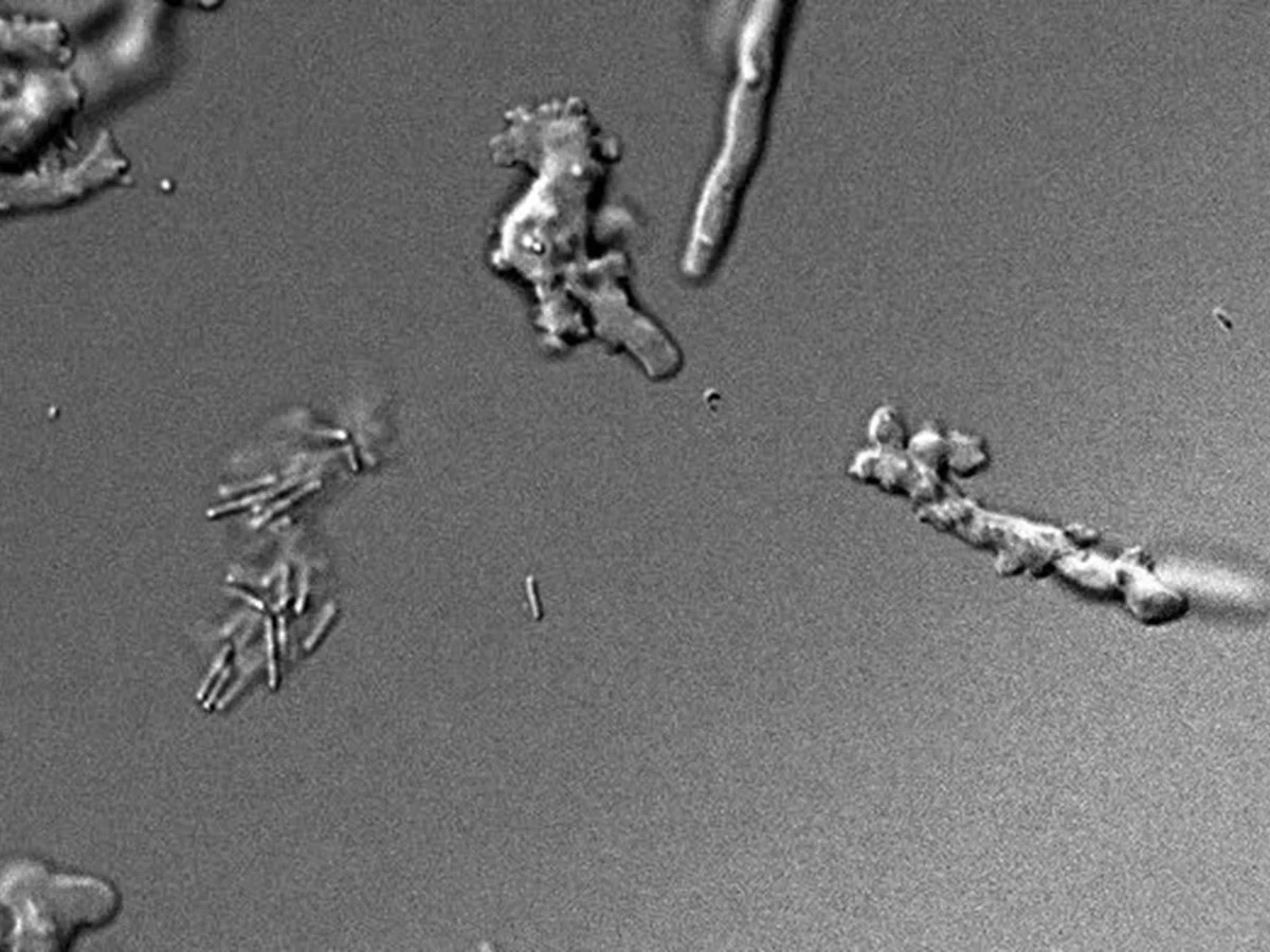 “Ameba de fogo”: cientistas descobrem espécie que sobrevive a 64 °C