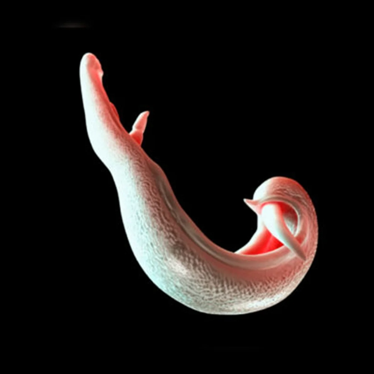 Anvisa aprova medicamento para doença parasitária em crianças de até 6 anos