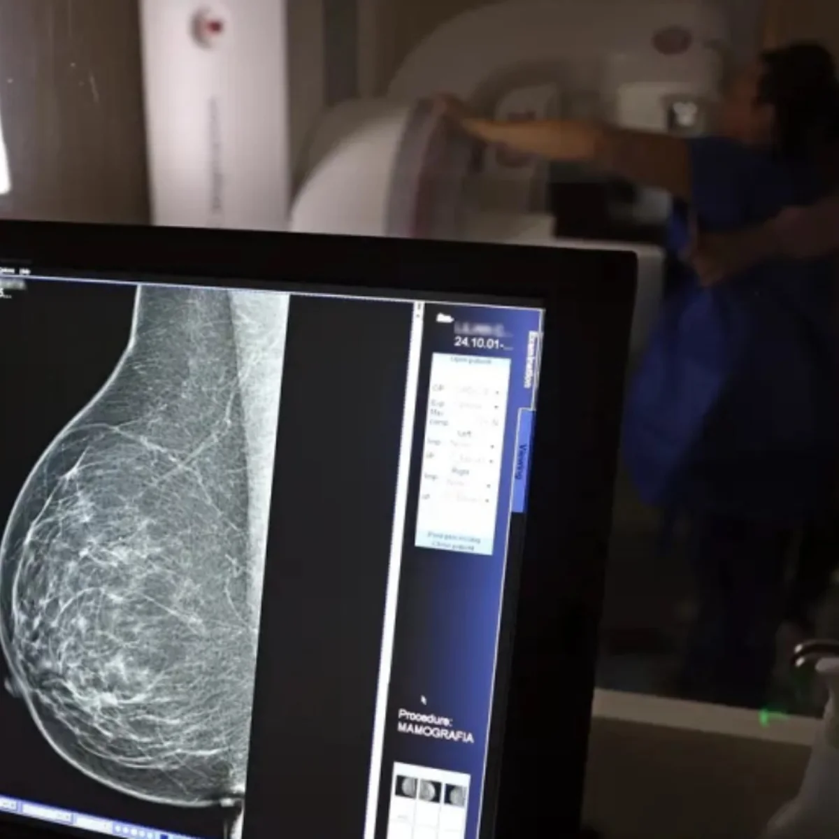 Outubro Rosa: tempo de espera por mamografia cai para 10 dias em BH