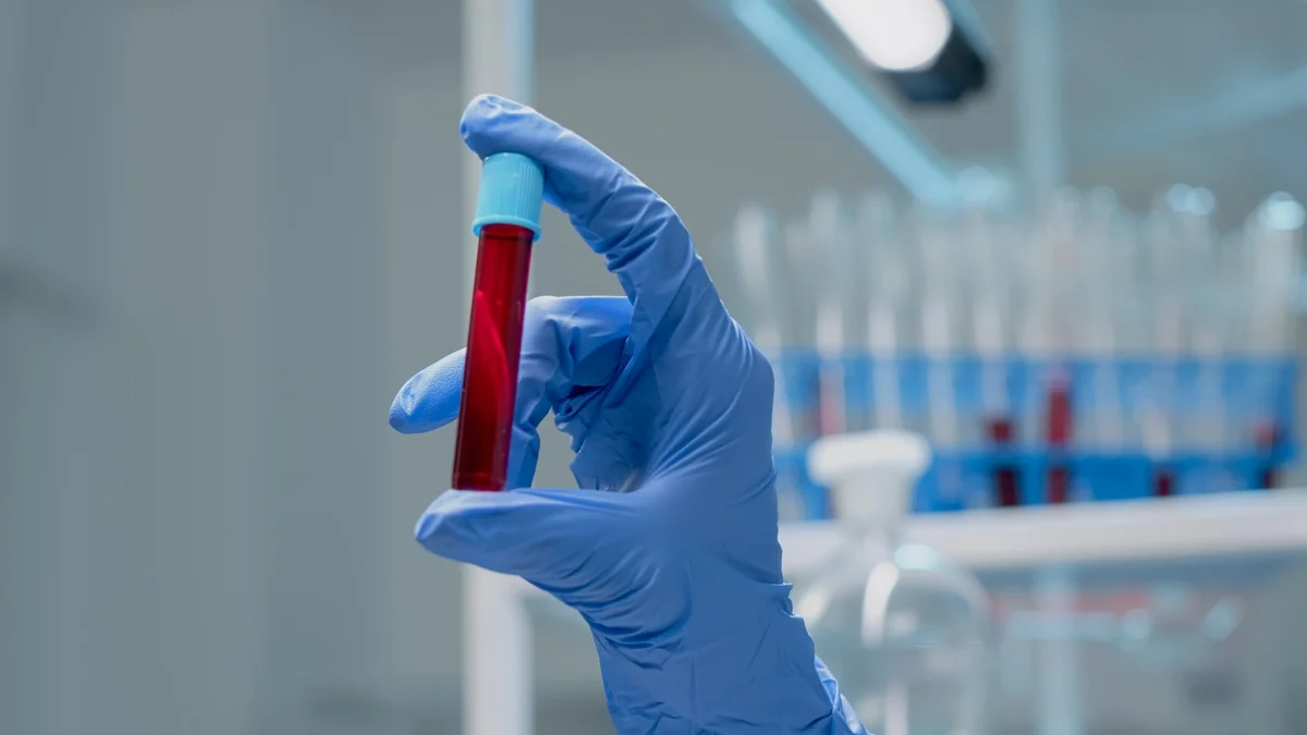 Novo exame de sangue que detecta mais de 50 tipos de câncer chega ao Brasil