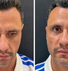 Cleitinho (Republicanos) faz harmonização um dia após vencer eleições Foto: Reprodução/Instagram